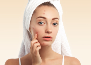 Top 8+ sữa rửa mặt cho da dầu mụn tốt nhất hiện nay