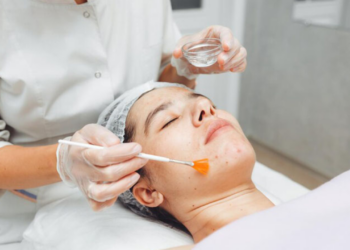 Peel da tại nhà là gì? Những lưu ý khi peel da tại nhà dành cho người mới