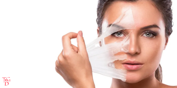 Peel da tại nhà là gì?